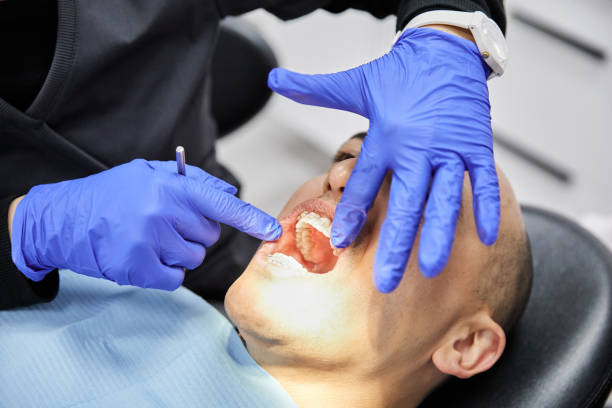 Best Emergency Gum Pain Relief  in Swanton, OH